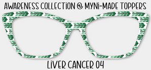 Liver Cancer 04